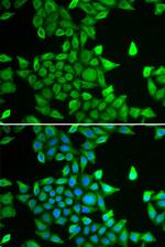 PSMA6 Antibody in Immunocytochemistry (ICC/IF)