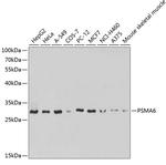 PSMA6 Antibody in Western Blot (WB)