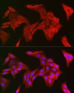 TRIM21 Antibody in Immunocytochemistry (ICC/IF)