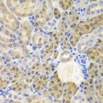 AKR1A1 Antibody in Immunohistochemistry (Paraffin) (IHC (P))