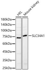 SLC34A1 Antibody in Western Blot (WB)