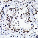 HDGF Antibody in Immunohistochemistry (Paraffin) (IHC (P))