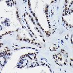 HDGF Antibody in Immunohistochemistry (Paraffin) (IHC (P))