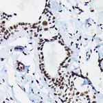 HDGF Antibody in Immunohistochemistry (Paraffin) (IHC (P))