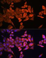 RRM1 Antibody in Immunocytochemistry (ICC/IF)