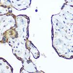 RhoA Antibody in Immunohistochemistry (Paraffin) (IHC (P))