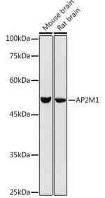 AP2M1 Antibody in Western Blot (WB)