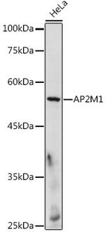 AP2M1 Antibody in Western Blot (WB)