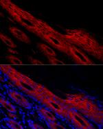 Periplakin Antibody in Immunocytochemistry (ICC/IF)