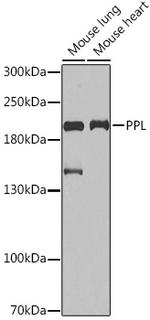 Periplakin Antibody in Western Blot (WB)