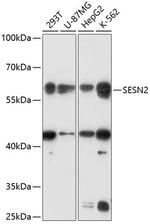 SESN2 Antibody in Western Blot (WB)