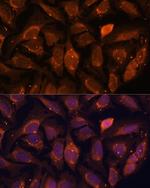 NDUFA4L2 Antibody in Immunocytochemistry (ICC/IF)