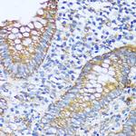 ACOT2 Antibody in Immunohistochemistry (Paraffin) (IHC (P))