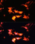 Folliculin Antibody in Immunocytochemistry (ICC/IF)