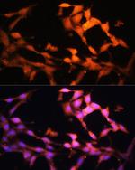 Folliculin Antibody in Immunocytochemistry (ICC/IF)