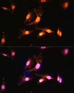 Folliculin Antibody in Immunocytochemistry (ICC/IF)