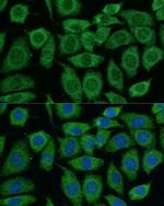 DLAT Antibody in Immunocytochemistry (ICC/IF)