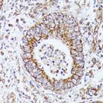 DLAT Antibody in Immunohistochemistry (Paraffin) (IHC (P))