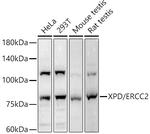 XPD Antibody in Western Blot (WB)