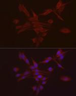 S100A10 Antibody in Immunocytochemistry (ICC/IF)