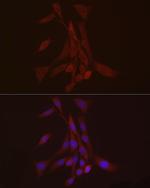 S100A10 Antibody in Immunocytochemistry (ICC/IF)