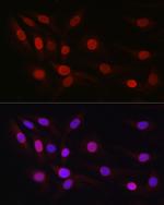 SP1 Antibody in Immunocytochemistry (ICC/IF)