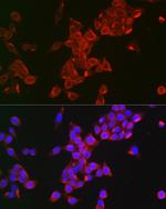 FSHR Antibody in Immunocytochemistry (ICC/IF)