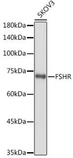 FSHR Antibody in Western Blot (WB)