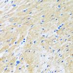 BAG3 Antibody in Immunohistochemistry (Paraffin) (IHC (P))