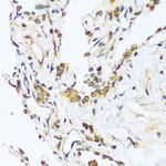 BAG3 Antibody in Immunohistochemistry (Paraffin) (IHC (P))