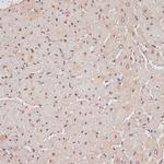 TLK1 Antibody in Immunohistochemistry (Paraffin) (IHC (P))