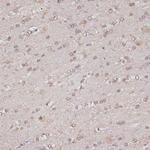 TLK1 Antibody in Immunohistochemistry (Paraffin) (IHC (P))