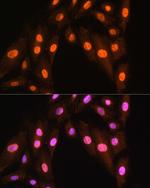 BRMS1 Antibody in Immunocytochemistry (ICC/IF)