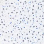 BRMS1 Antibody in Immunohistochemistry (Paraffin) (IHC (P))