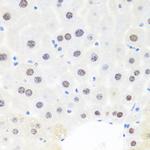 BRMS1 Antibody in Immunohistochemistry (Paraffin) (IHC (P))