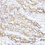 Aquaporin 1 Antibody in Immunohistochemistry (Paraffin) (IHC (P))