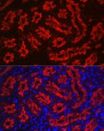 Aquaporin 1 Antibody in Immunohistochemistry (Paraffin) (IHC (P))