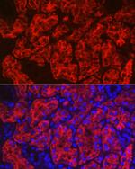 Aquaporin 1 Antibody in Immunohistochemistry (Paraffin) (IHC (P))