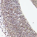 TET1 Antibody in Immunohistochemistry (Paraffin) (IHC (P))