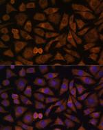 RABIF Antibody in Immunocytochemistry (ICC/IF)