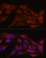 TGF beta-1 Antibody in Immunocytochemistry (ICC/IF)