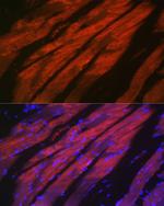 MYH2 Antibody in Immunocytochemistry (ICC/IF)