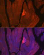 MYH2 Antibody in Immunocytochemistry (ICC/IF)