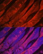 MYH2 Antibody in Immunocytochemistry (ICC/IF)