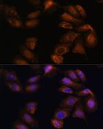 ROBO1 Antibody in Immunocytochemistry (ICC/IF)