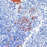 S100A8 Antibody in Immunohistochemistry (Paraffin) (IHC (P))