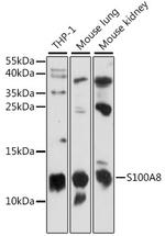 S100A8 Antibody in Western Blot (WB)