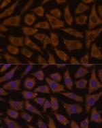 MTMR4 Antibody in Immunocytochemistry (ICC/IF)