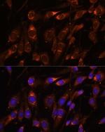 FARSB Antibody in Immunocytochemistry (ICC/IF)