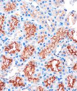 IQGAP2 Antibody in Immunohistochemistry (Paraffin) (IHC (P))